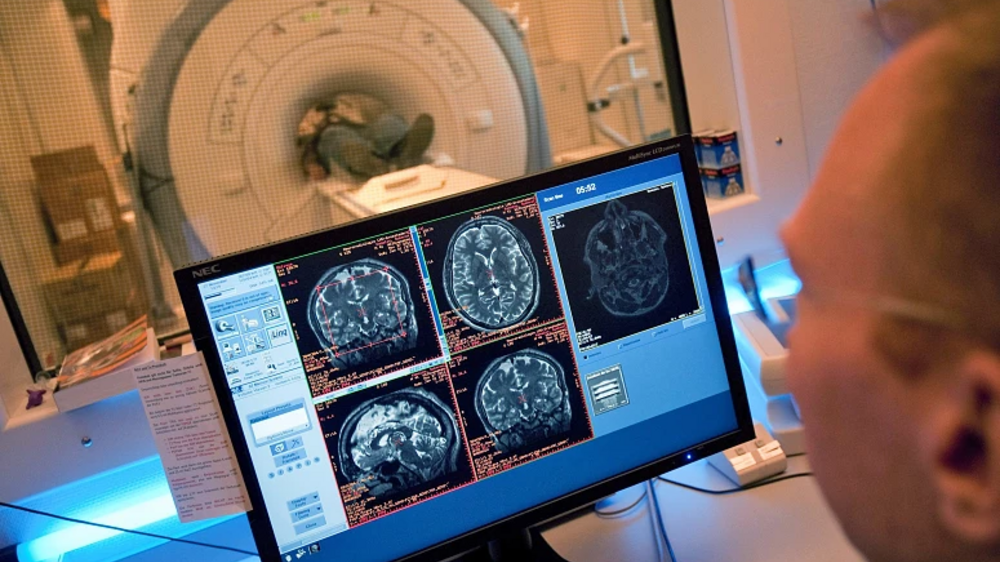 Análise de exames cerebrais revela dados sobre sobrevivência de mulheres com cancro em 2018