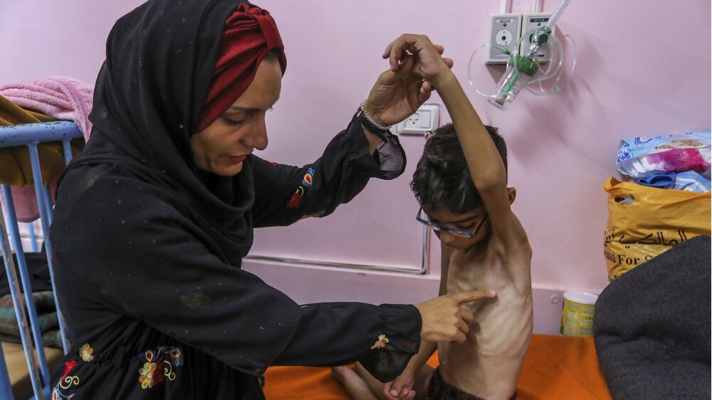 Criança subnutrida recebe assistência em Gaza, onde a crise humanitária se agrava