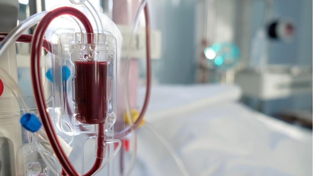 SNS investe em hemodiálise, ultrapassando 236ME em tratamentos.
